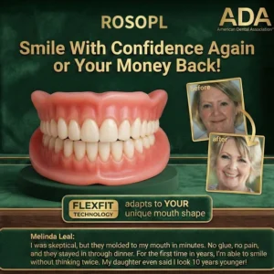 ROSOPL™ Custom-Fit Full Functional Dentures