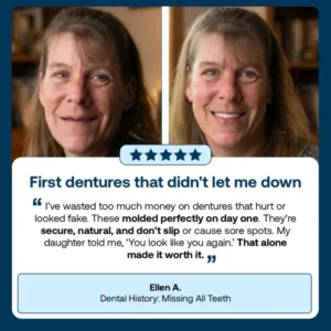 ROSOPL™ Custom-Fit Dentures