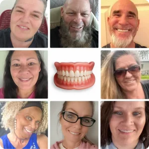 ROSOPL™ Custom-Fit Full Functional Dentures