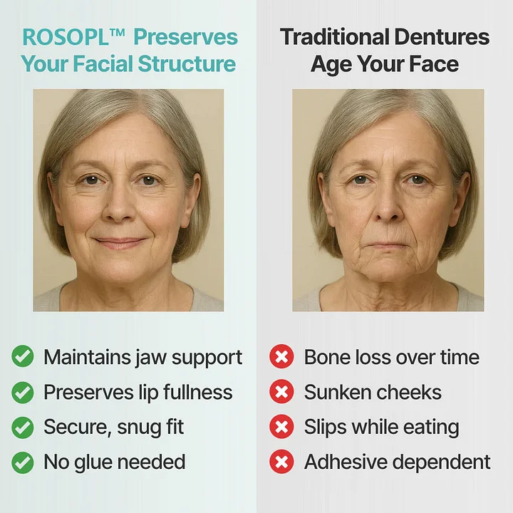 ROSOPLTM Custom-Fit Full Functional Dentures