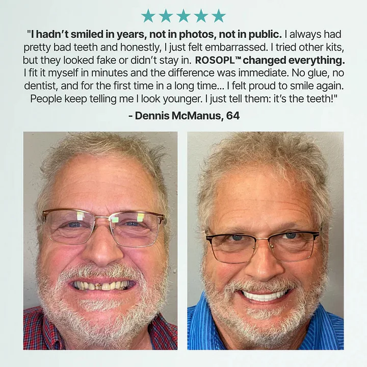 ROSOPLTM Medical Full Denture with Strong Suction