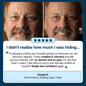 ROSOPL Custom-Fit Full Functional Dentures