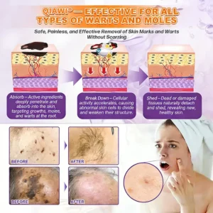 ROSOPL® Biotin 10-in-1 Skin Restoration Cream