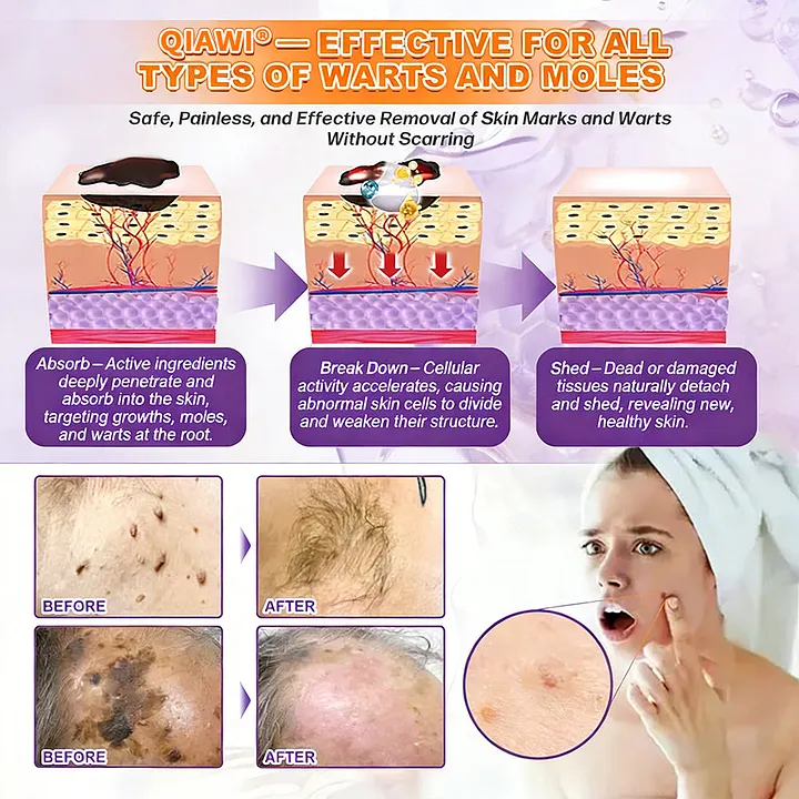 ROSOPL® Biotin 10-in-1 Skin Restoration Cream